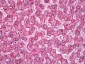 MNSOD / SOD2 Antibody